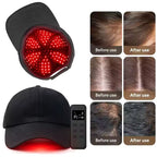 NEW Hair Growth Cap Infrared Therapy 660nm 940nm Red Light AntiHair Loss